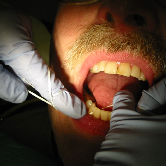 Dental_flossing